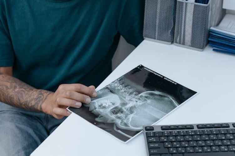 Dental Digital X-Ray Market Report 2024 - Dental Digital X-Ray Market Share And Size