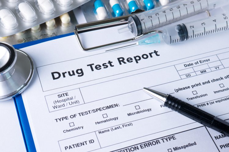 Understanding the Drug Abuse Profile (Urine Test): Purpose, Procedure, and Results