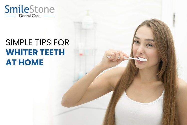 5 Simple Tips for Whiter Teeth at Home