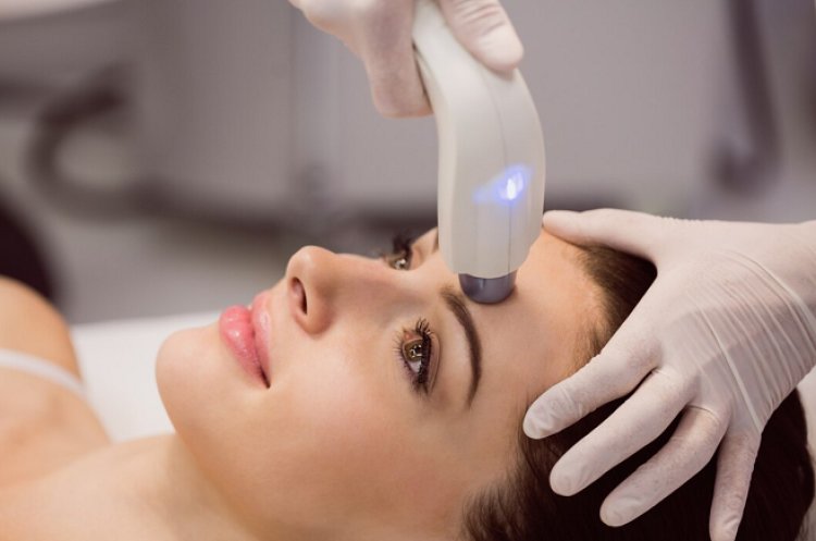 Laser Acne Scar Removal Compares to Other Treatments in Singapore