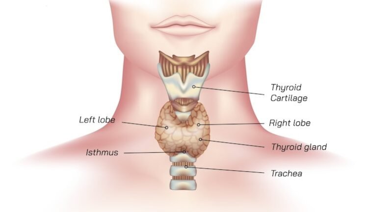 Discover the 5 Causes of Thyroid and What are the Solutions!