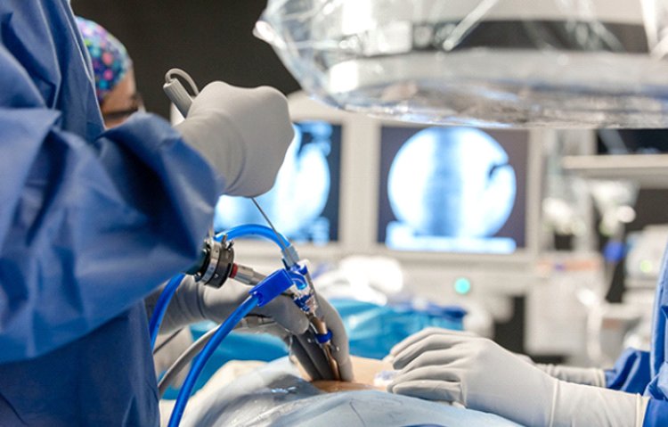 Minimally invasive lumbar spine surgery