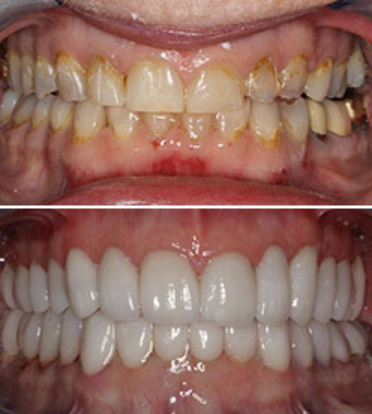 Best Dentist in Jamnagar