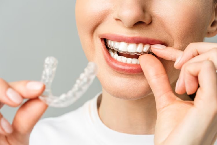 What does Invisalign treatment include?