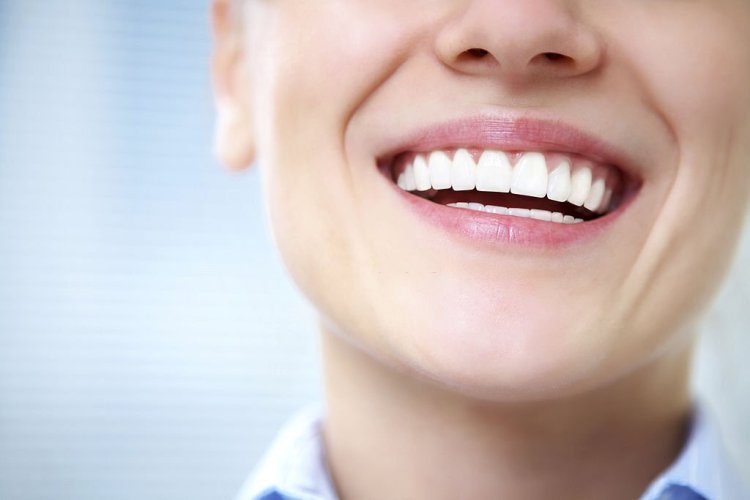 Your Secret Weapon for a Whiter Smile: Home Whitening Kits