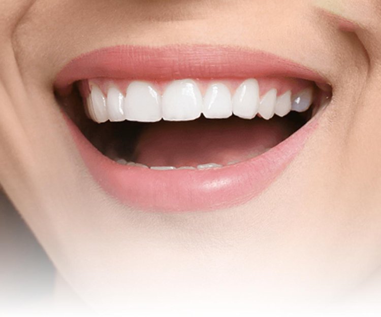 Your Investment in Radiance: The Dubai Hollywood Smile