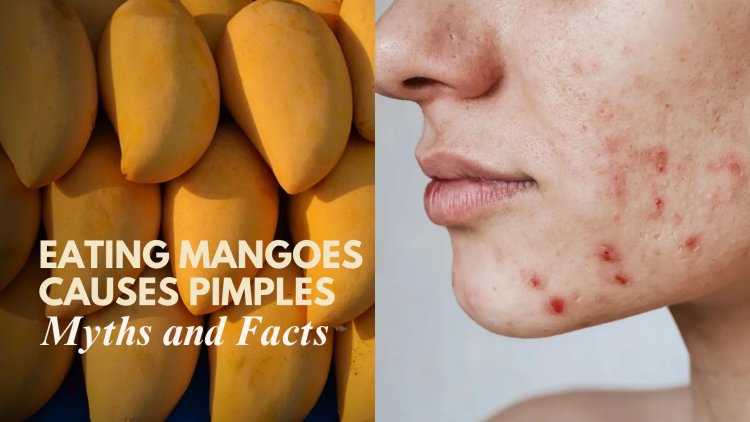 Eating Mangoes Causes Pimples – Myth or Reality