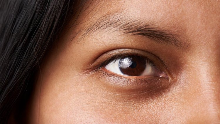 What Is The Best Eye Cream for Puffy Eyes?