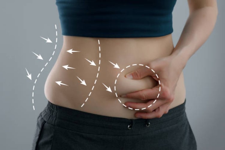How to Prepare for a Tummy Tuck in Dubai