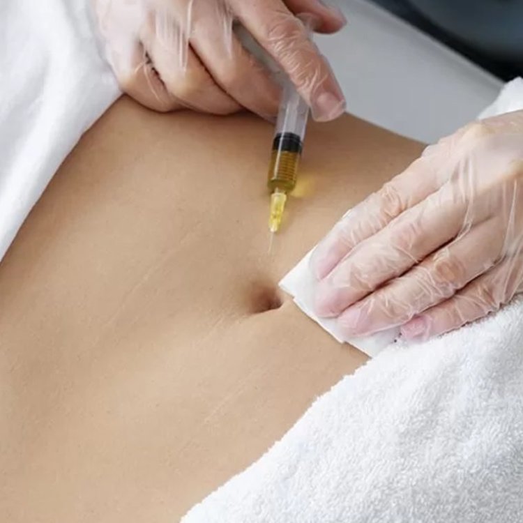 Budgeting for Fat Dissolving Injections: What You Need to Know