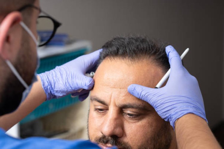 Hair Transplantation Process in Dubai