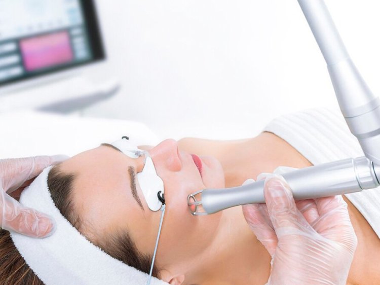 Fractional Laser: The Key to Reducing Sun Damage
