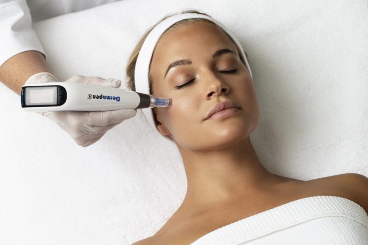 How Dermapen Helps Reduce Fine Lines & Wrinkles