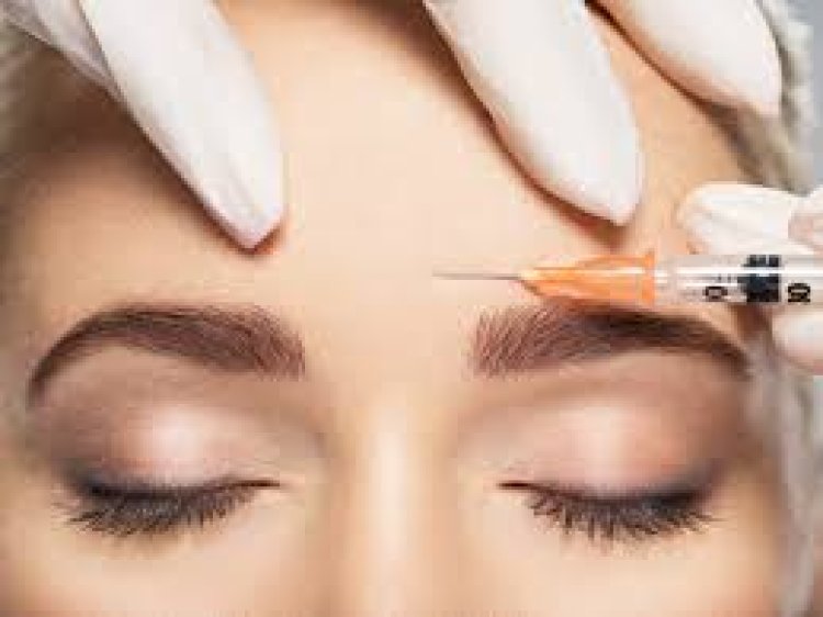 The Botox Blueprint: Top 5 Areas for Wrinkle-Free Radiance