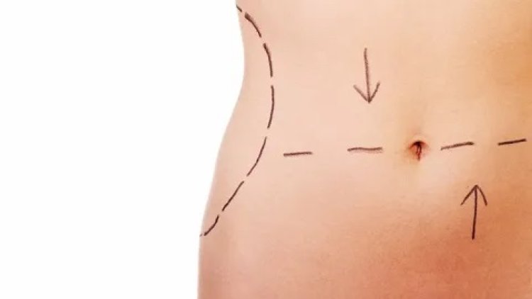 VASER Liposuction in Dubai: Benefits and Recovery