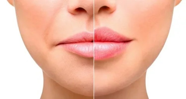 How Surgeon Experience Influences Lip Reduction Cost in Dubai