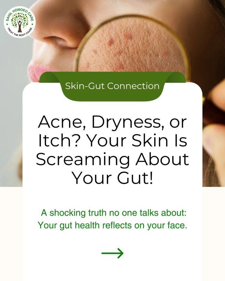 Best Homeopathic Medicine for Acne Treatment | Sahil Homoeo Care