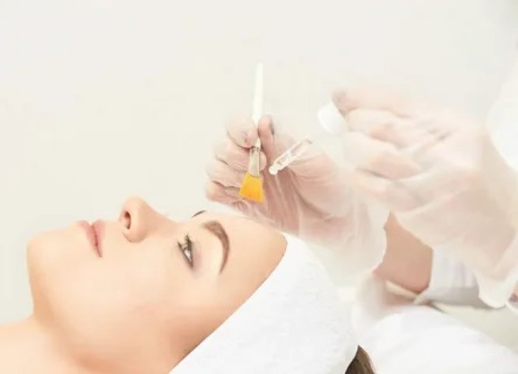 Summer Skin Rescue: Are Chemical Peels Safe During Dubai's Hot Months?