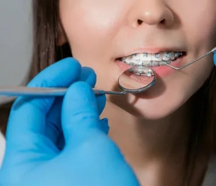 Emergency Orthodontic Care in Dubai: What to Do If a Wire Breaks or a Bracket Comes Off