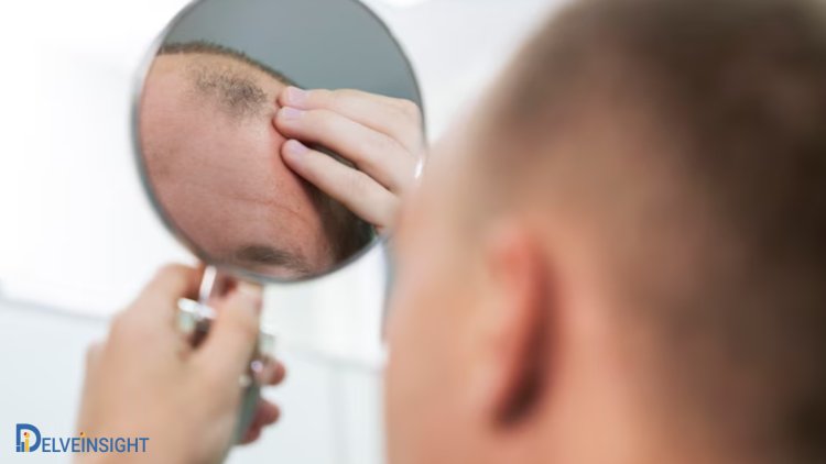 Alopecia Areata Market expected to expand at ~27% CAGR by 2034 | Insights by DelveInsight covering EMA, PMDA, FDA approvals, clinical trials, treatments, prevalence, and key players
