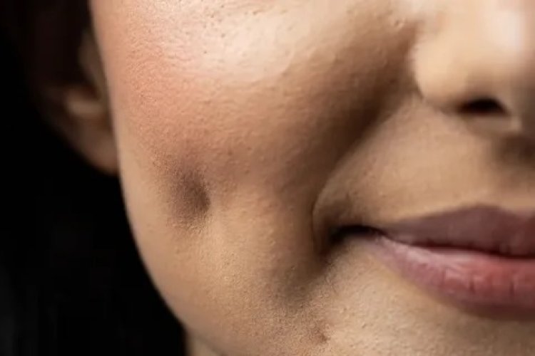 The Cost of Dimple Creation Surgery in Dubai: Factors Influencing Price