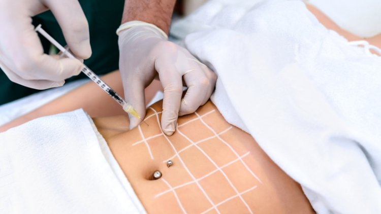The Timeline of Fat Dissolving Needle Results in Dubai: When Can You See a Difference?