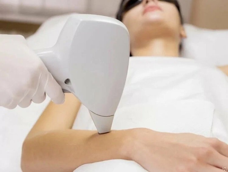 Laser Skin Lightening: Myths vs. Facts