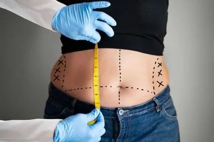 Advanced Cannula Designs for Optimized Laser Delivery and Aspiration in GPS Laser Liposuction