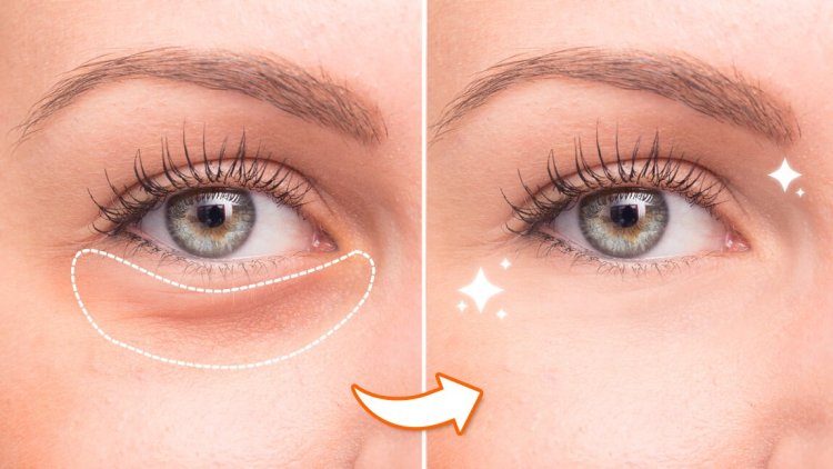 Microneedling with Advanced Serums: Enhancing Collagen Production for Firmer Under-Eyes