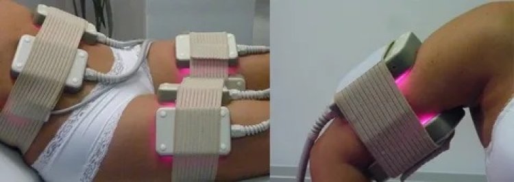 The GPS Laser Liposuction Procedure: Step-by-Step Breakdown of What to Expect
