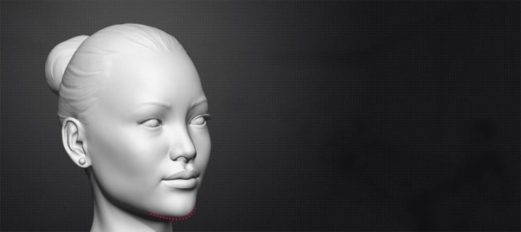 Is Chin Reduction Surgery Safe?