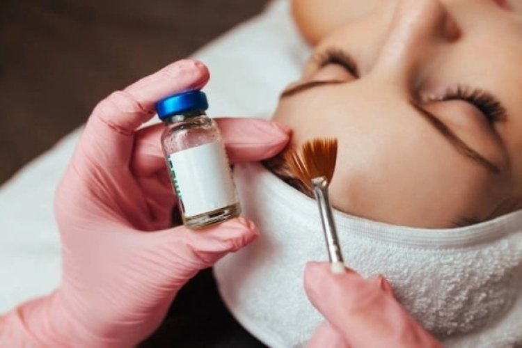Chemical Peels for Dark Spots: A Comprehensive Guide