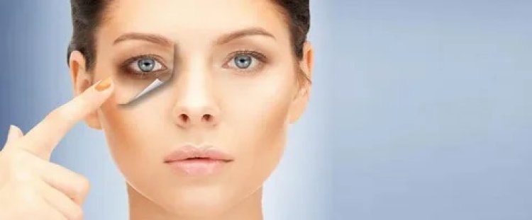 Potential Side Effects and Downtime Associated with Popular Dark Circle Treatments in Dubai