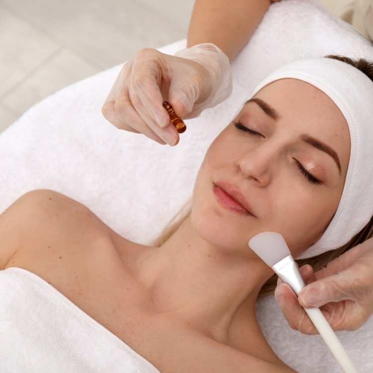 What Are Chemical Peels and Are They Right for Your Skin?