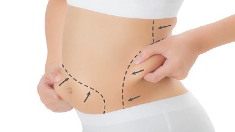 Liposuction for Men in the UAE: Addressing Male Body Contouring Goals