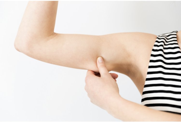 Why Is Arm Lift Surgery Popular Among Women 40+?