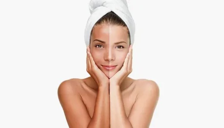 Skin Whitening for Wedding Preparations in Islamabad