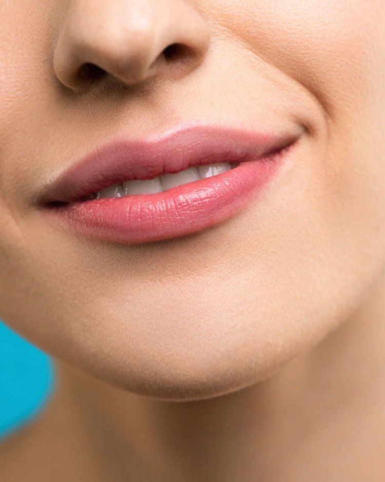 Best Time of Year to Get Lip Fillers in Islamabad