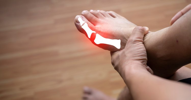 Uric Acid Treatment in Homeopathy | Sahil Homoeo Care