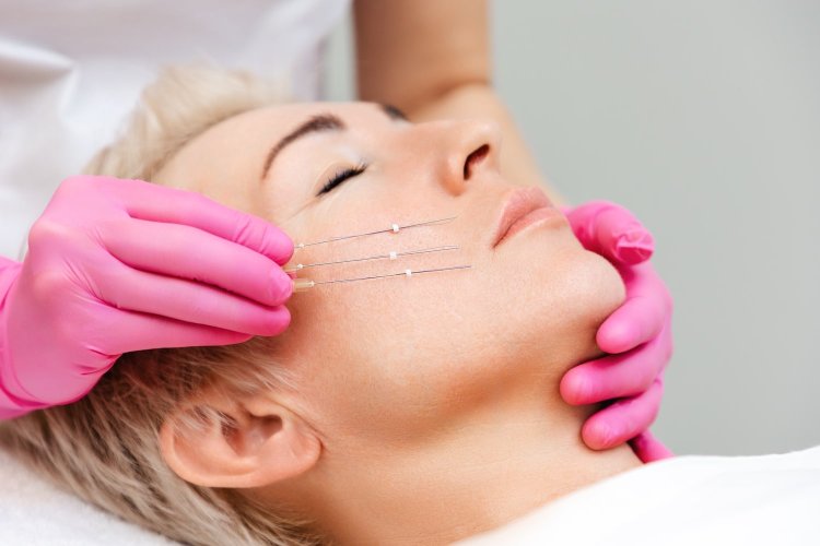 Top 5 Myths About Thread Lift Debunked