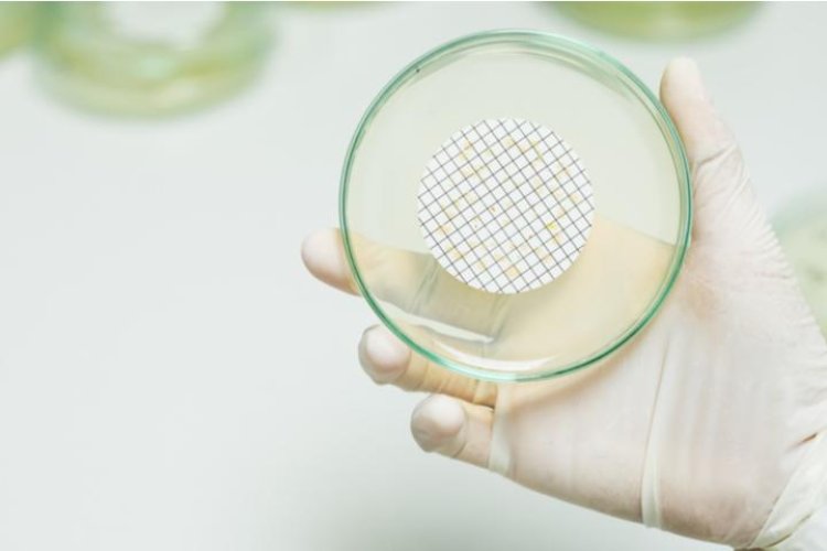 Medical Membrane Market Share, Demand and Forecast Report 2025-2033