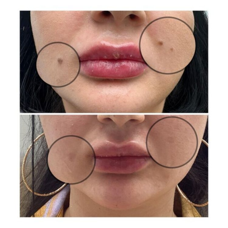 Rediscover Your Radiance A Guide to Richmond's Top Skin Clinics