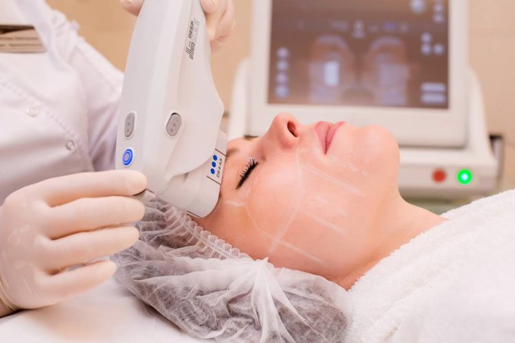Is There Any Financing for HIFU Treatment in Islamabad?