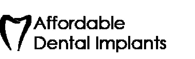 Queens Affordable Dental Implants