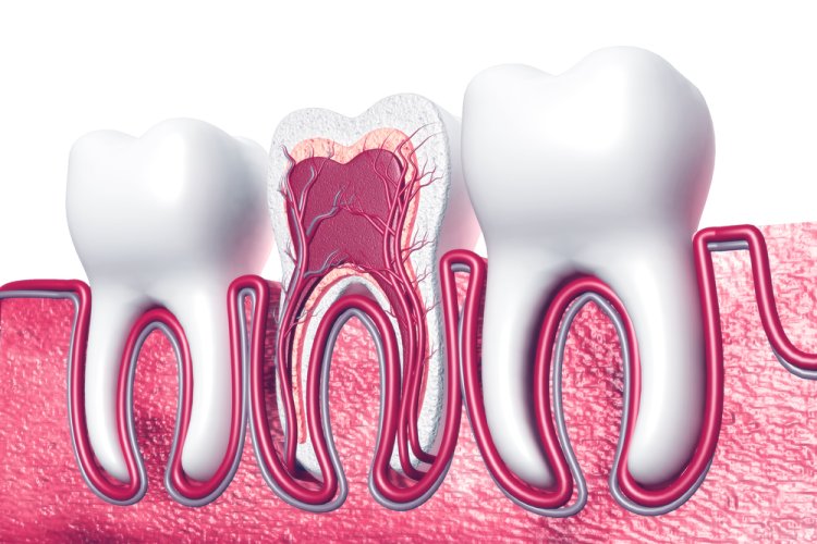 Mobile Dental Clinics in Islamabad: Are They Safe for Root Canals?