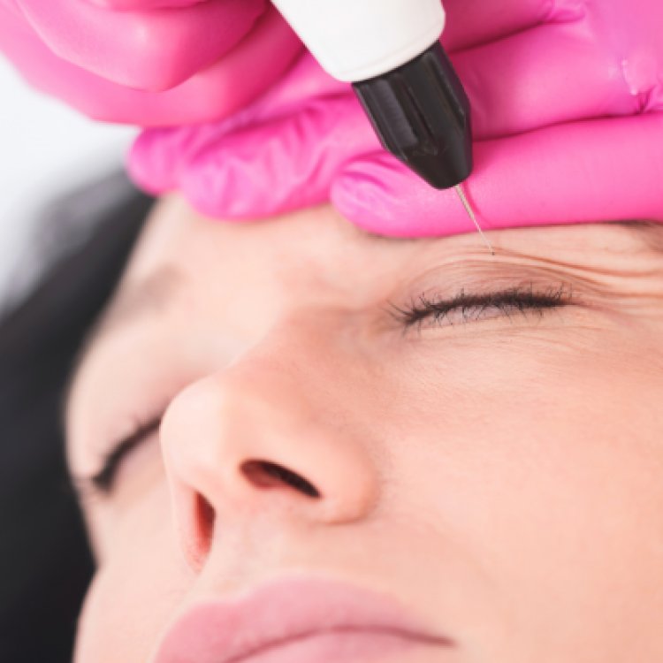 Does Drinking More Water Reduce Eye Puffiness?