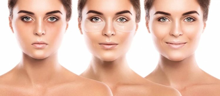 Dark Circle Treatment: Choose Right Serum