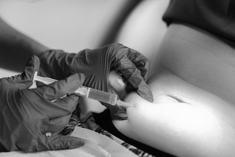 Fat Melting Injection: Non-Surgical Slimming