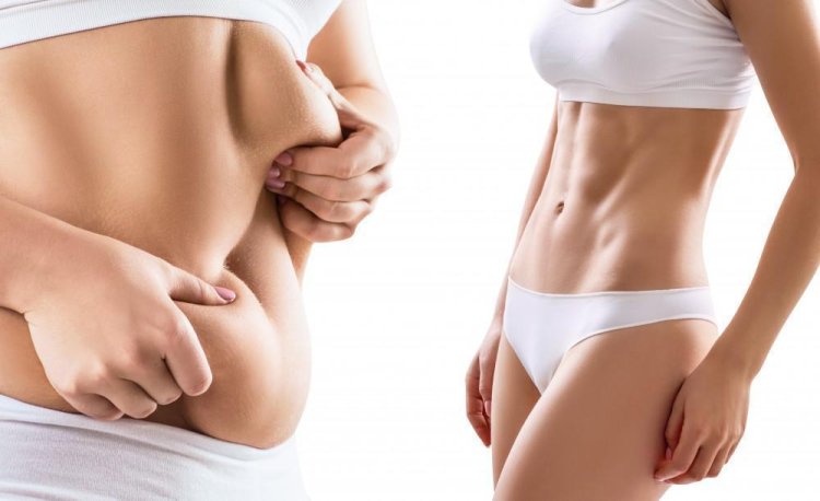 Liposuction Surgery for Stubborn Belly Fat