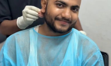 Can You Use Hair Serum After a Hair Transplant?